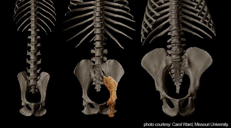 Human evolution redefined by findings of the 10 million years old fossil of Rudapithecus