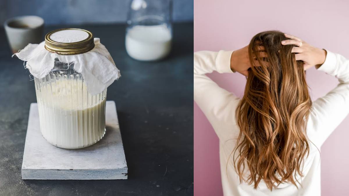 How To Get Rid Of Dandruff Using Home Remedies?