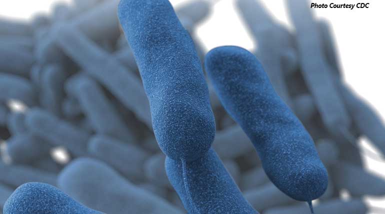 Legionnaires disease kills one in North Carolina