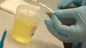 Home Urine Test Helps in Early Detection of Prostate Cancer