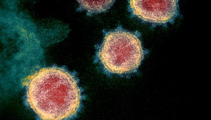 Lockdowns alone cannot work for coronavirus